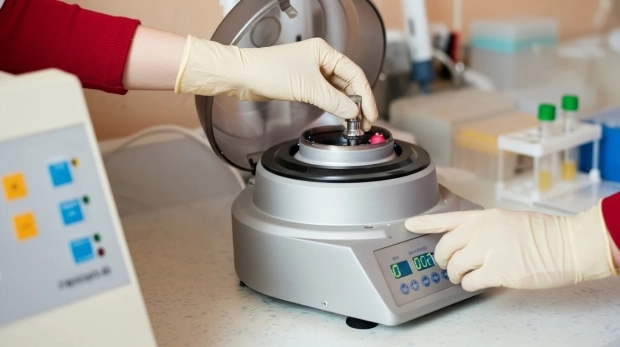 63. Otro Centrifugación Directo